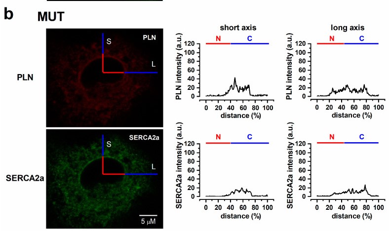 Subcellular PLN and SERCA2a localization in MUT.jpg